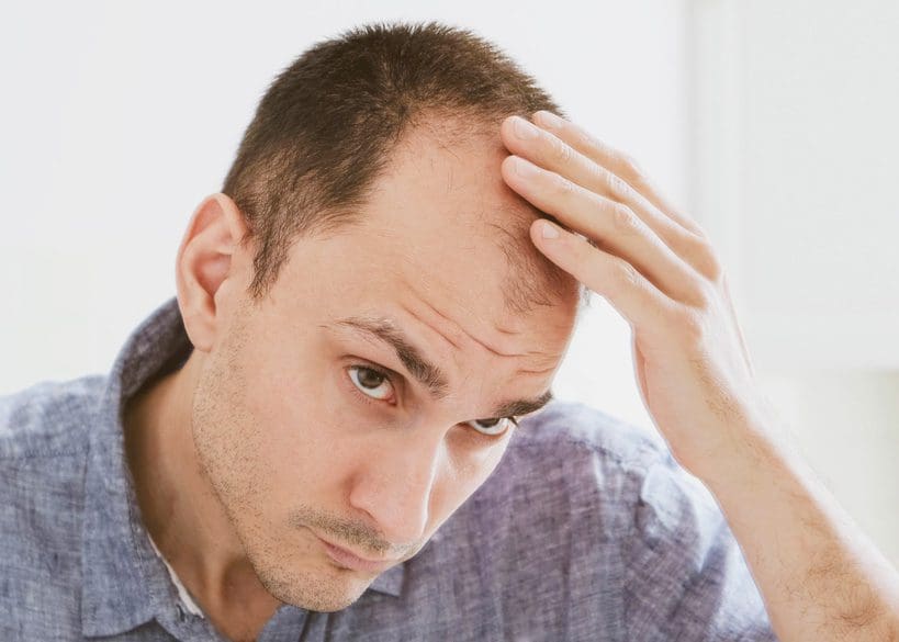 AHI-Clinic_Blog_Man-Hair-loss