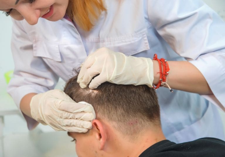 Hair Transplant Before and After AHI Clinic London