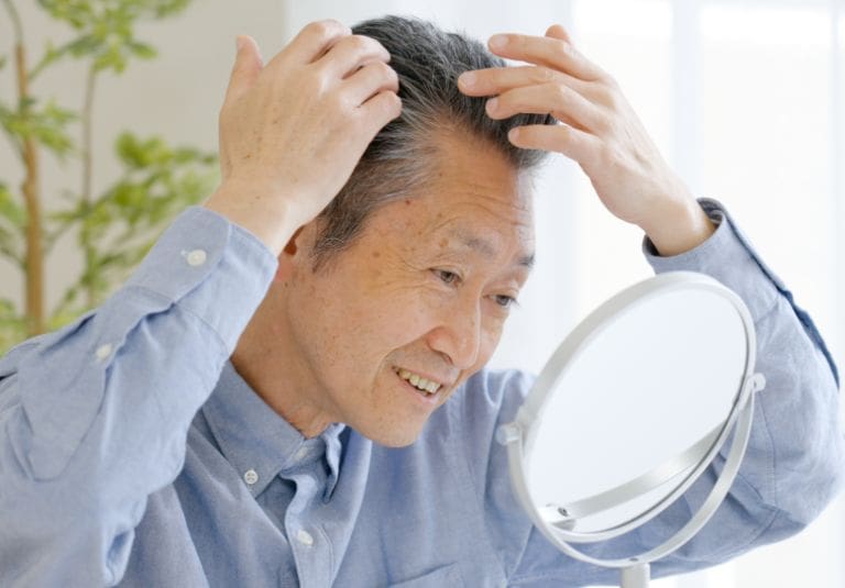 Hair Transplant Success Rate AHI Clinic